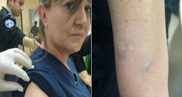 Hemşireyi darbeden hasta yakını serbest bırakıldı