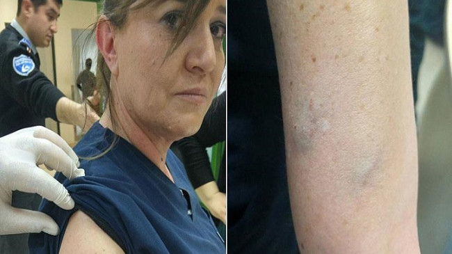 Hemşireyi darbeden hasta yakını serbest bırakıldı